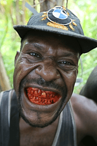 man with a red mouth and tooth decay from chewing betel nuts